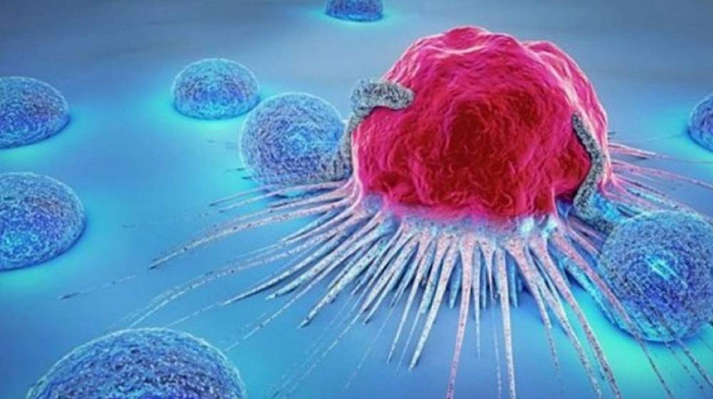 دعوات للتحقيق في أسباب ارتفاع السرطان في لبنان